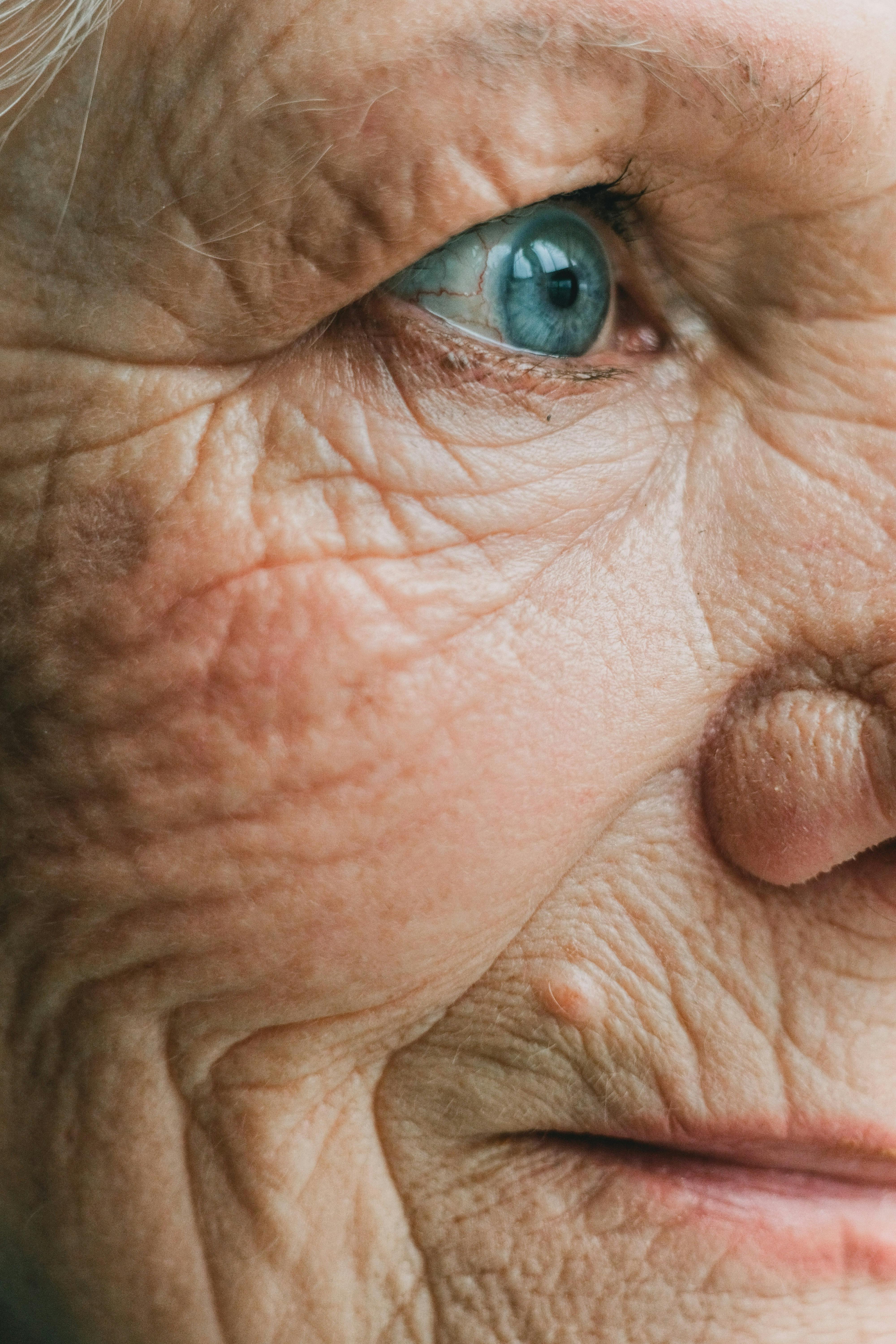 How to Reduce Wrinkles in Aging Skin
